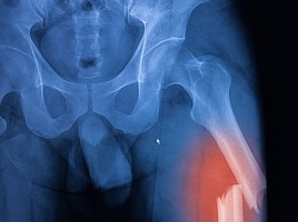 Unfallchirurgie