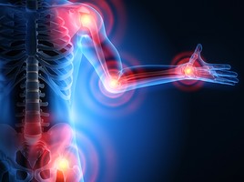 Geschwollene Gelenke, schmerzender Rücken – Ist es Rheuma?