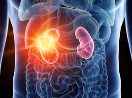 Nephrologie